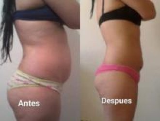 yesoterapia a domicilio