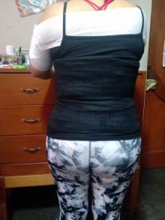 yesoterapia a domicilio