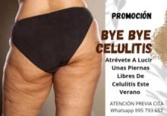 Reducción de Celulitis Surco-Higuereta