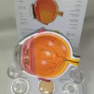 Maqueta tipos de catarata