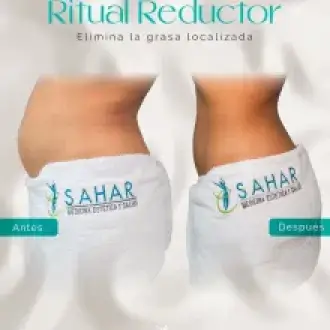  Quieres reducir abdomen moldear cintura