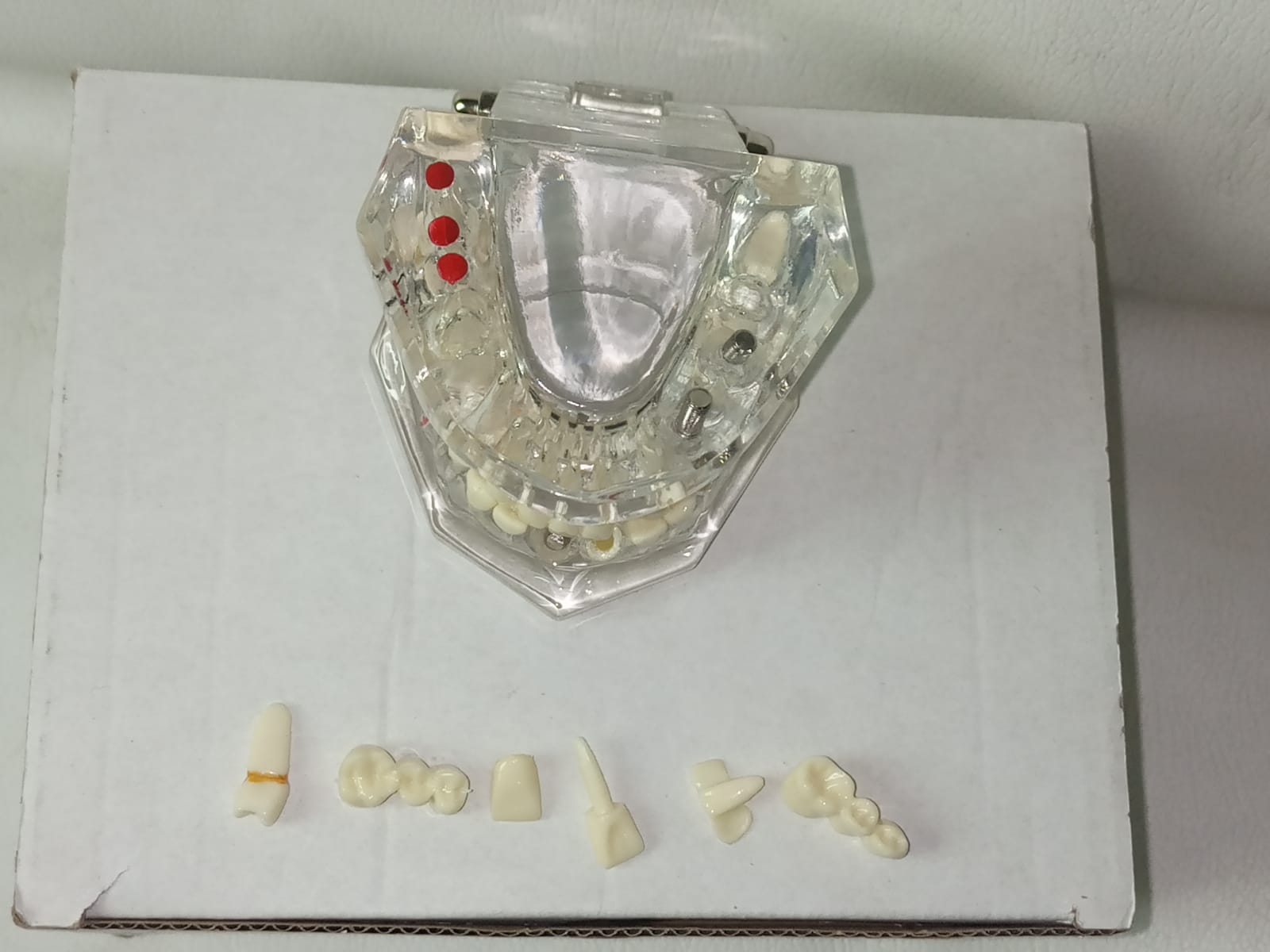 Modelo de implante dental con patologías