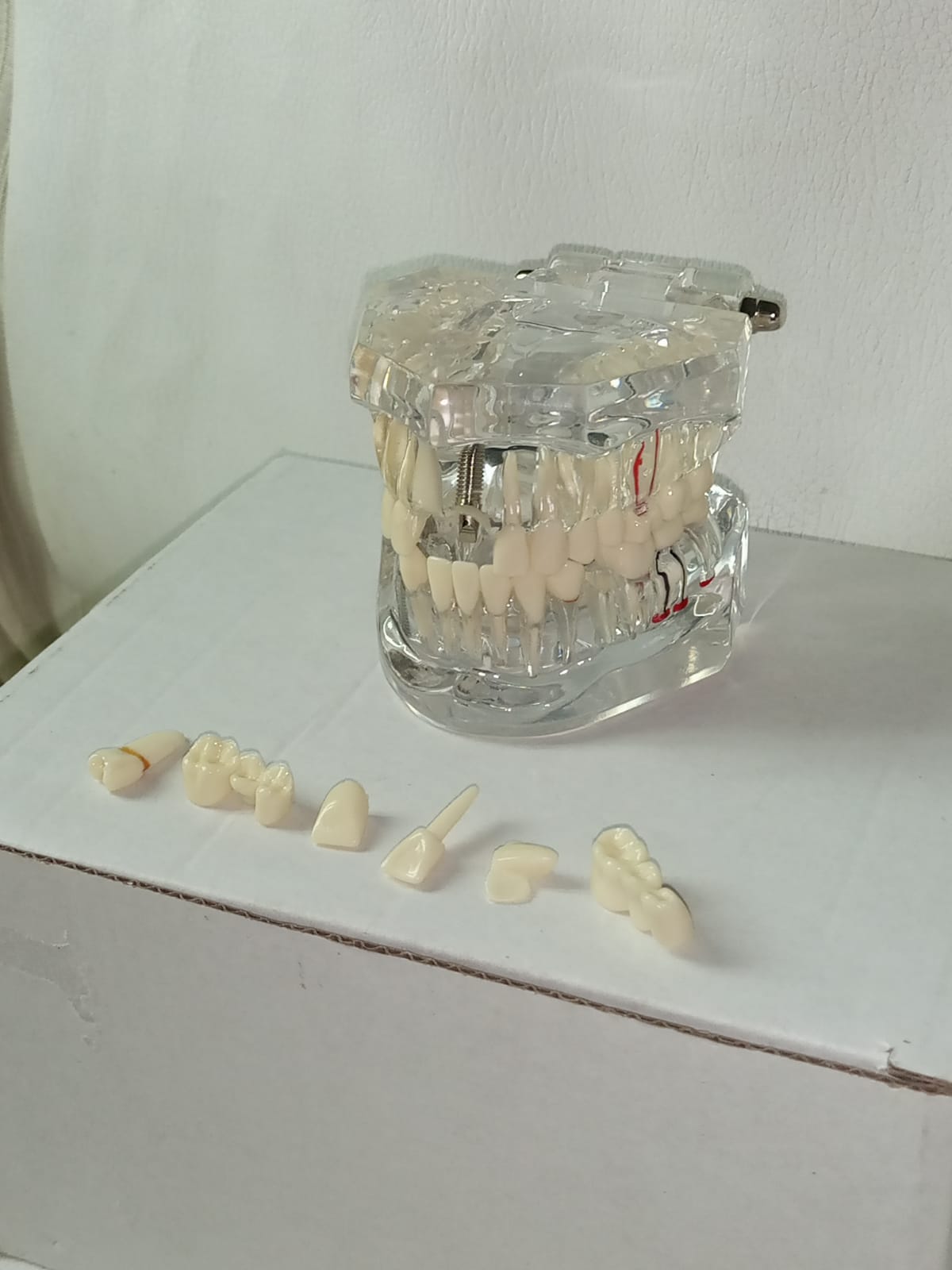 Modelo de implante dental con patologías