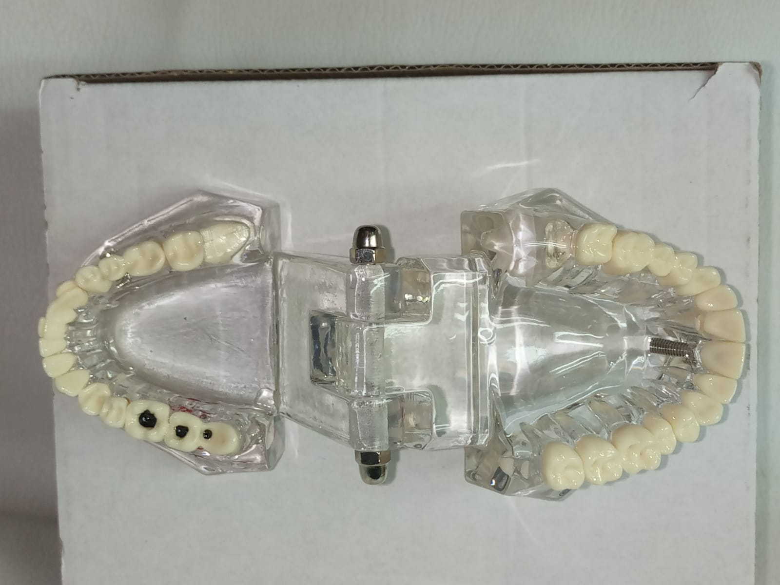 Modelo de implante dental con patologías