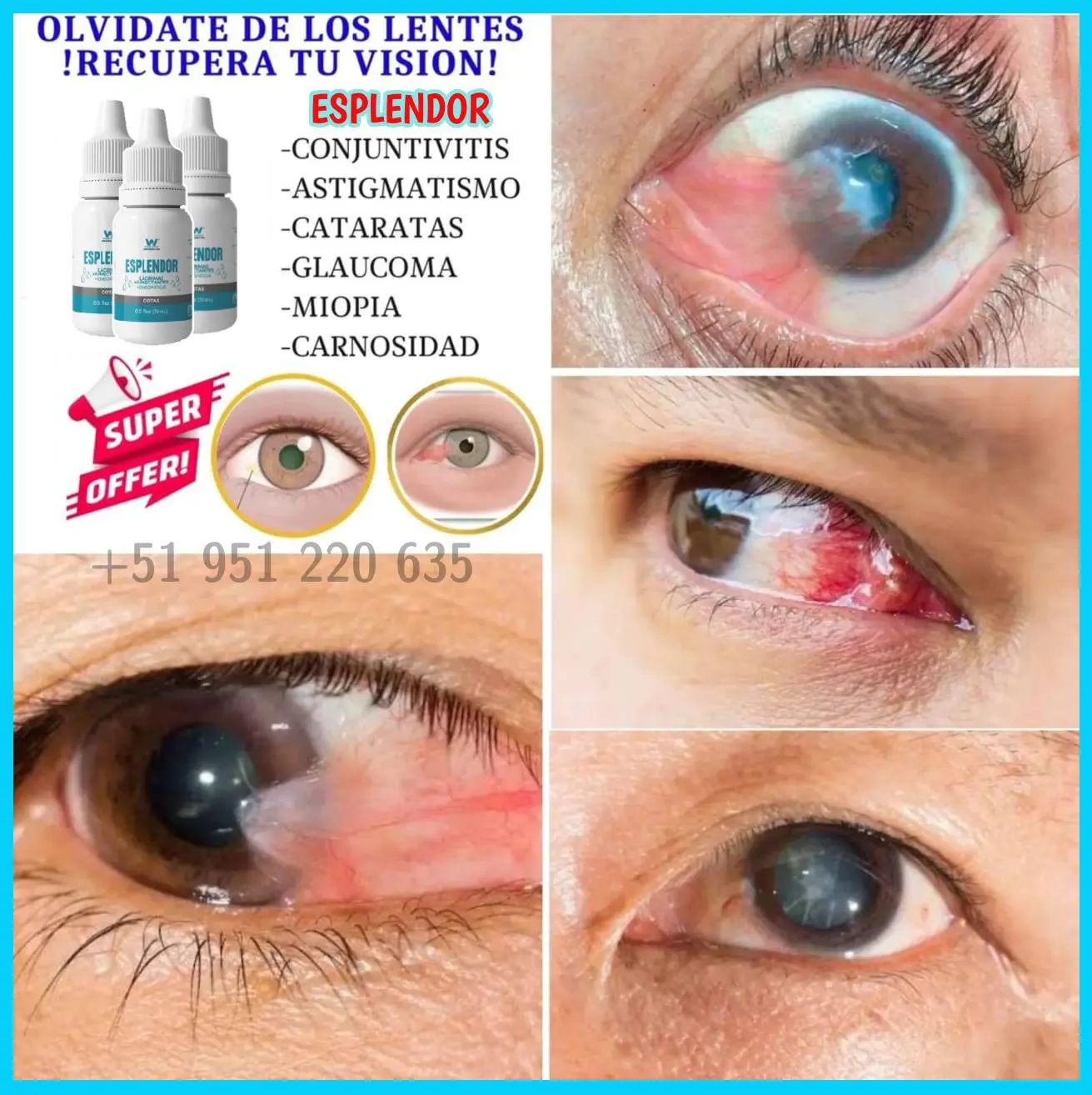 Gotas Esplendor Para Los Ojos